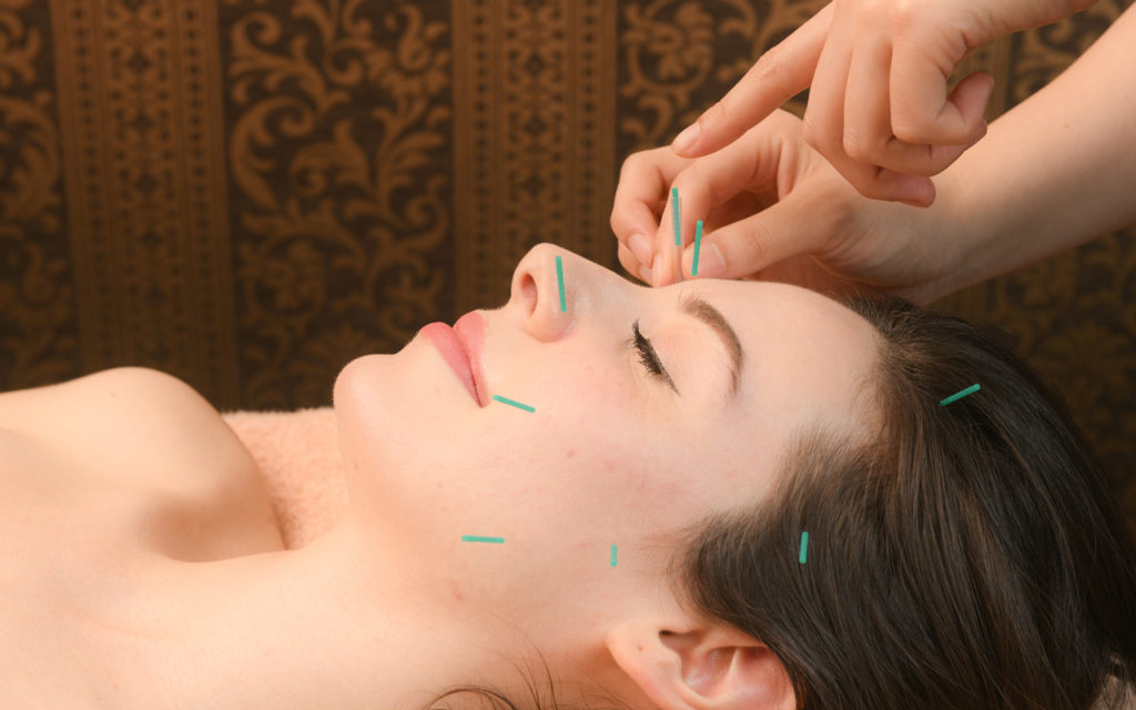 Photo of cosmetic acupuncture